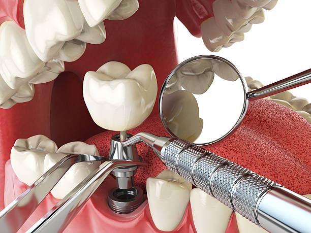 Best Weekend Emergency Dental Services in Menahga, MN